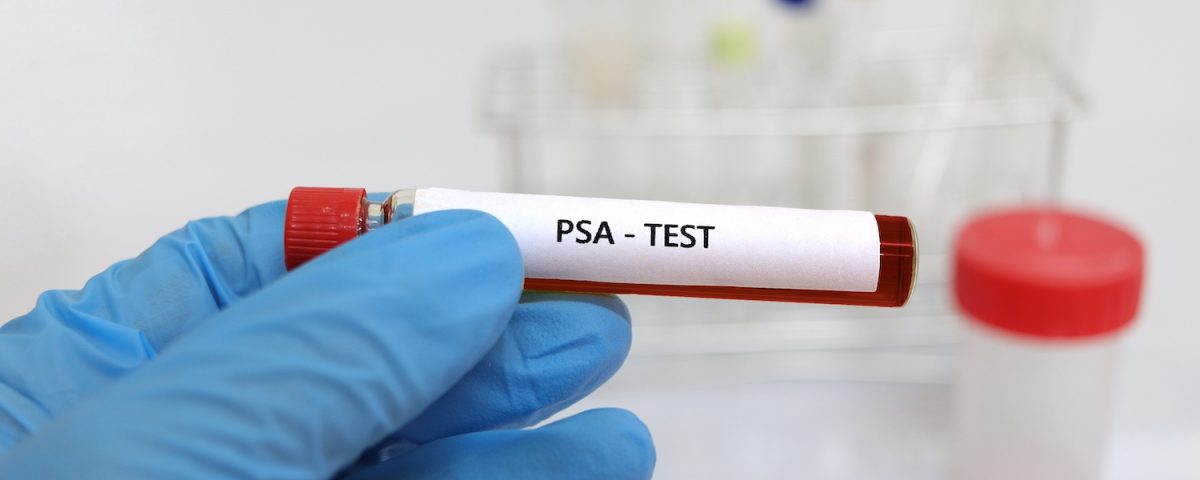 Προστάτης ουρολόγος ανδρολογος Σέρρες